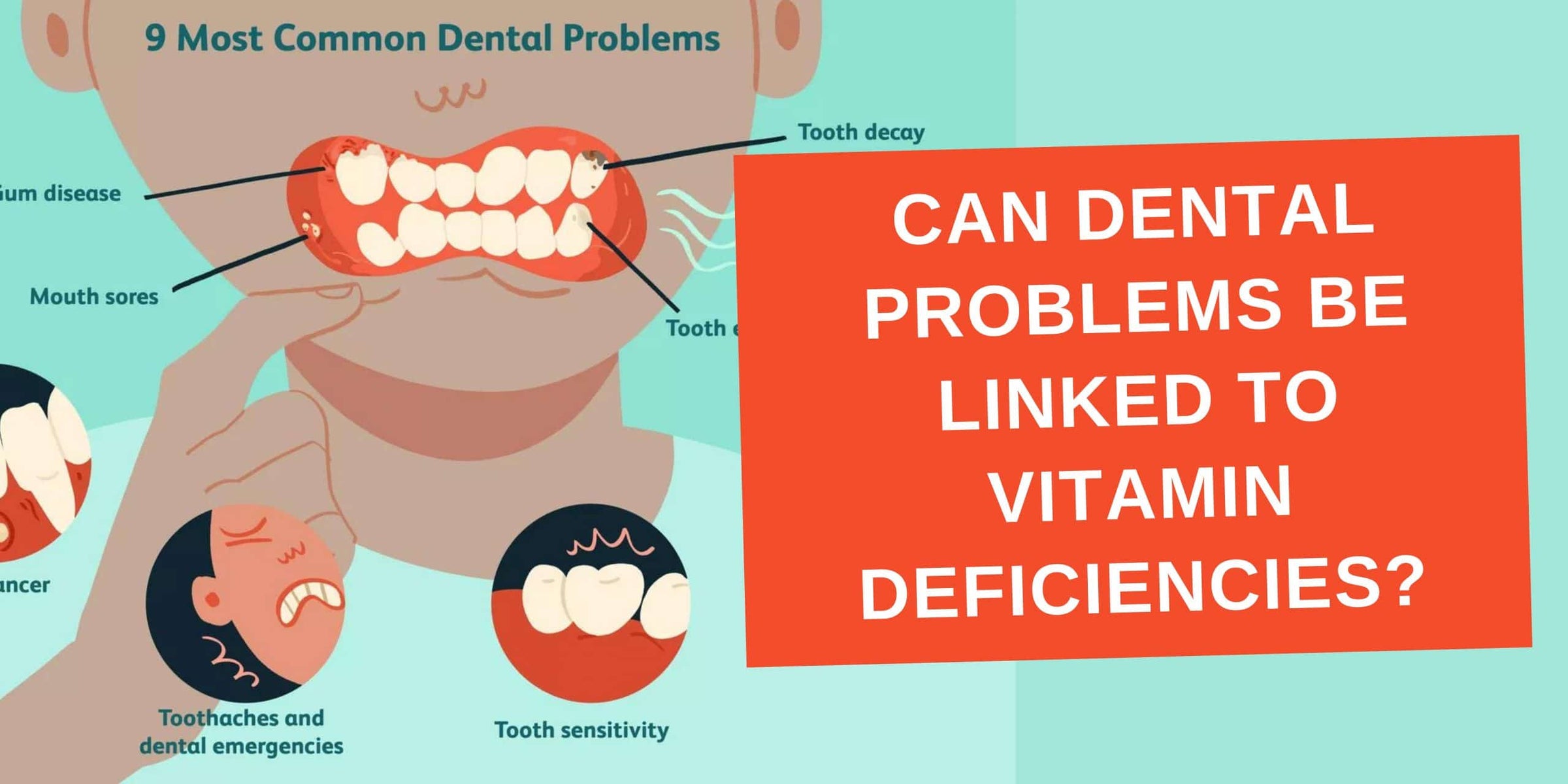 Can Dental Problems be Linked to Vitamin Deficiencies? Image