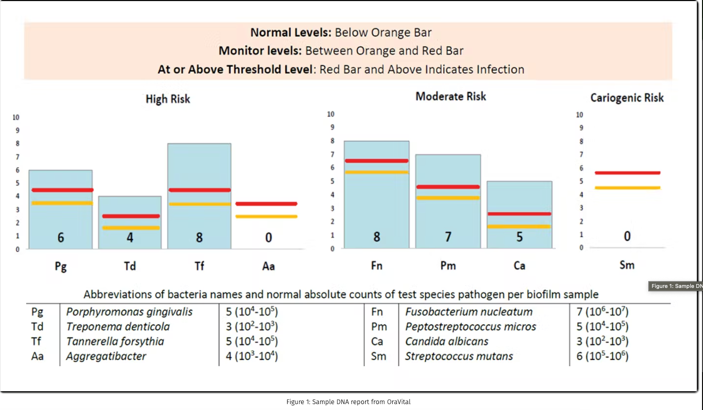 Reducing the need for adjunctive antibiotics during scaling and root planing, by Dr. Scott Froum Image