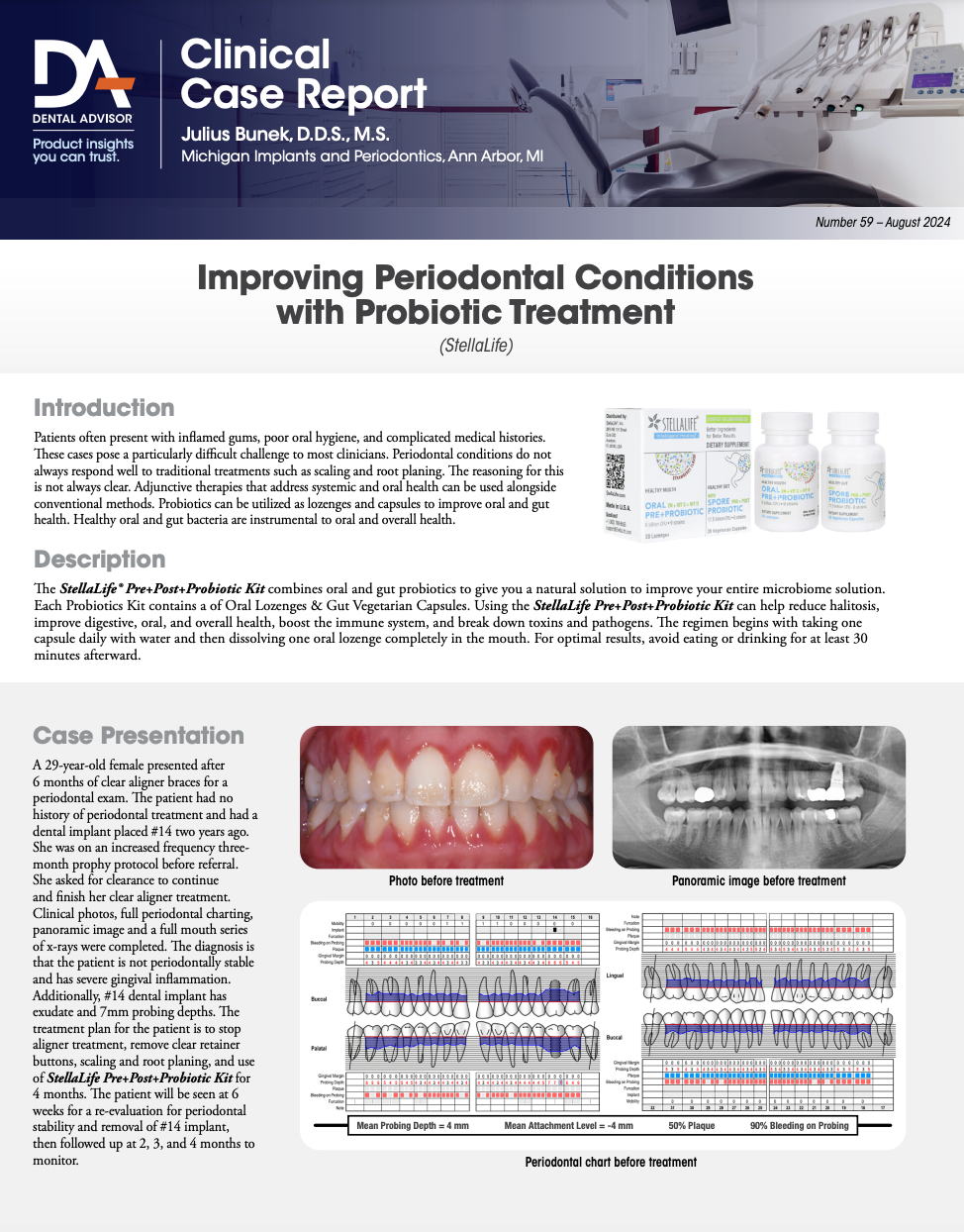 Improving Periodontal Conditions with Probiotic Treatment by Dental Advisor Image
