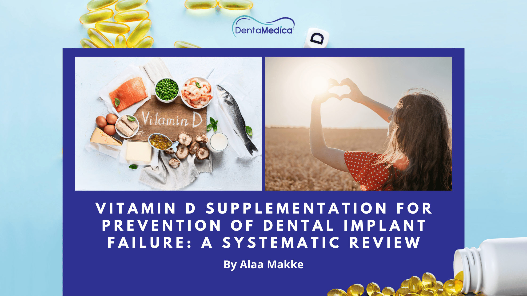 Vitamin D Supplementation for Prevention of Dental Implant Failure: A Systematic Review Image
