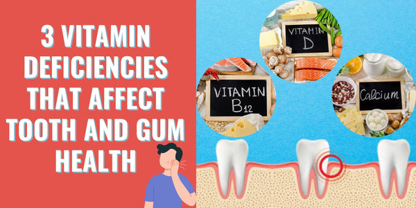 3 Vitamin Deficiencies that Affect Tooth and Gum Health
