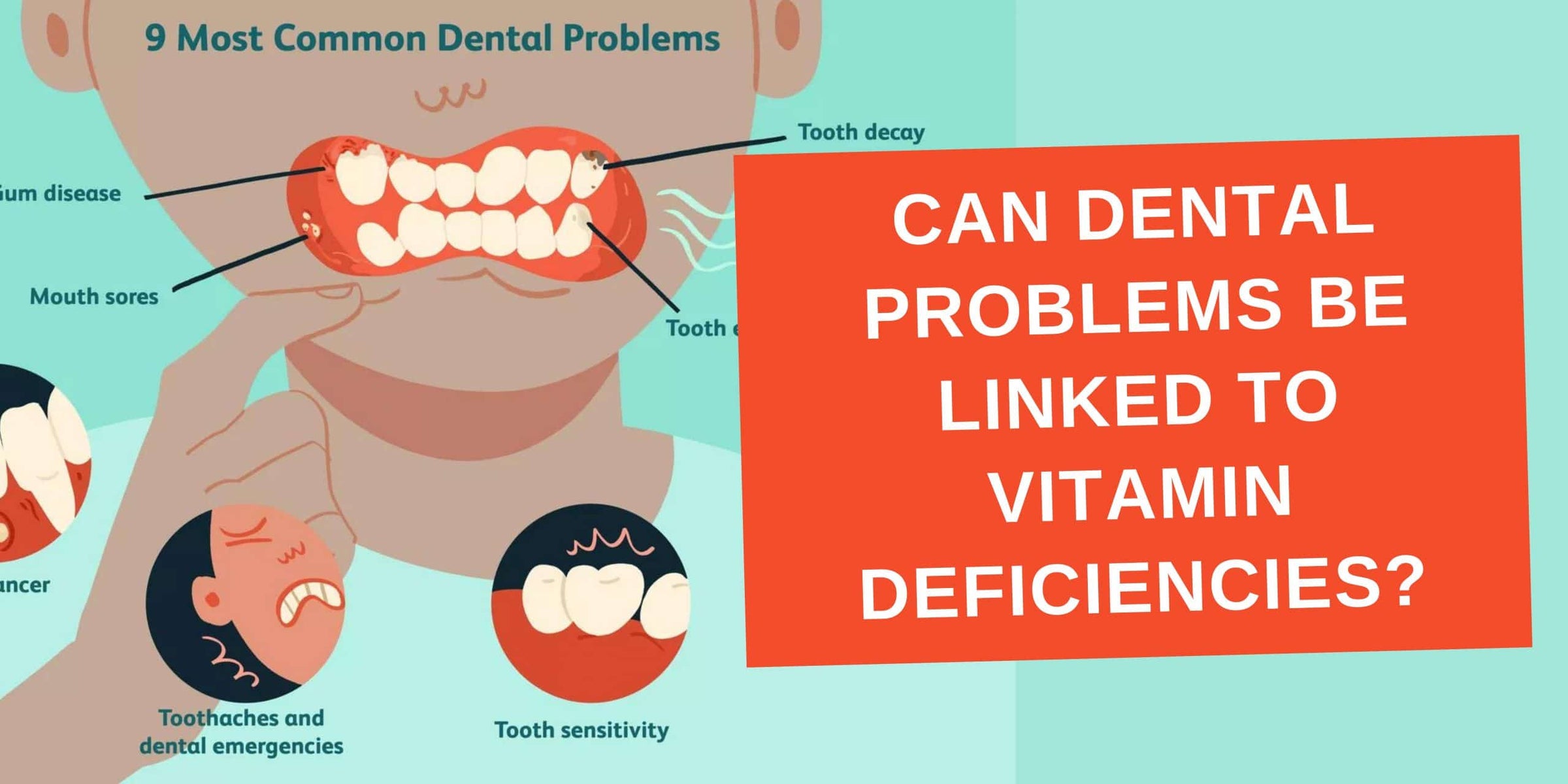 Can  Dental Problems be Linked to Vitamin Deficiencies? Image