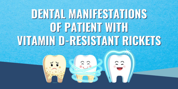 Dental manifestations of patient with Vitamin D-resistant rickets