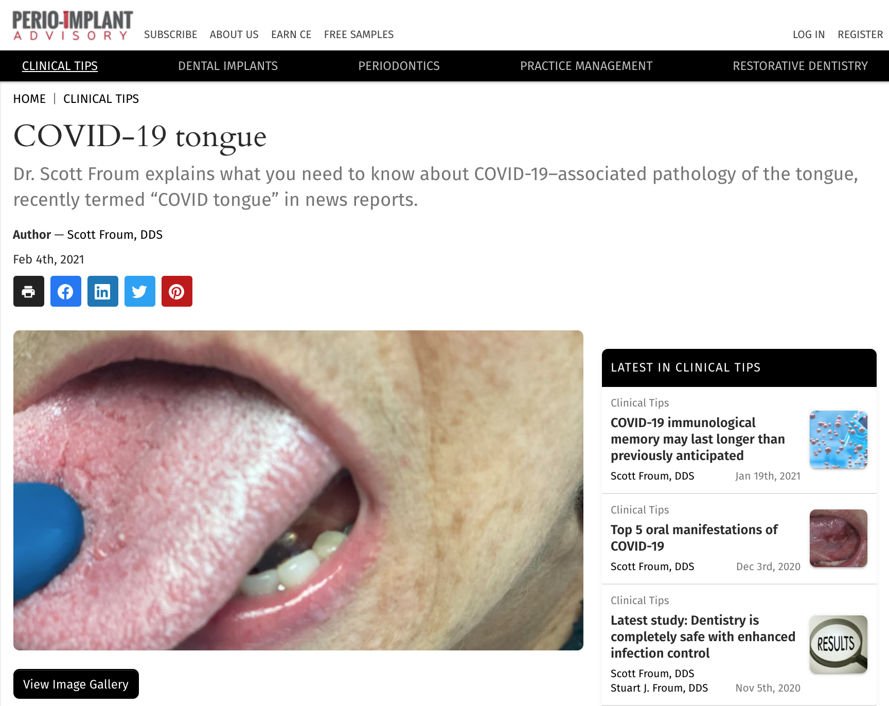 COVID-19 tongue, by Scott Froum, DDS Image