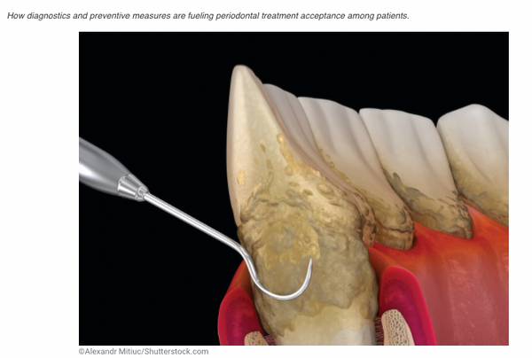 Periodontal Priorities: The Diagnostics and Treatment Changing Perio Care