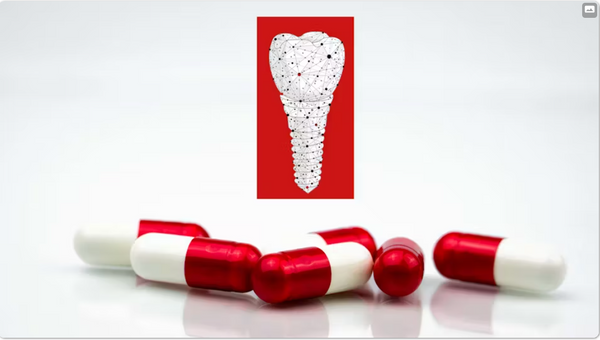 Antibiotics: Are they needed for dental implant placement?  by  Dr. Scott Froum