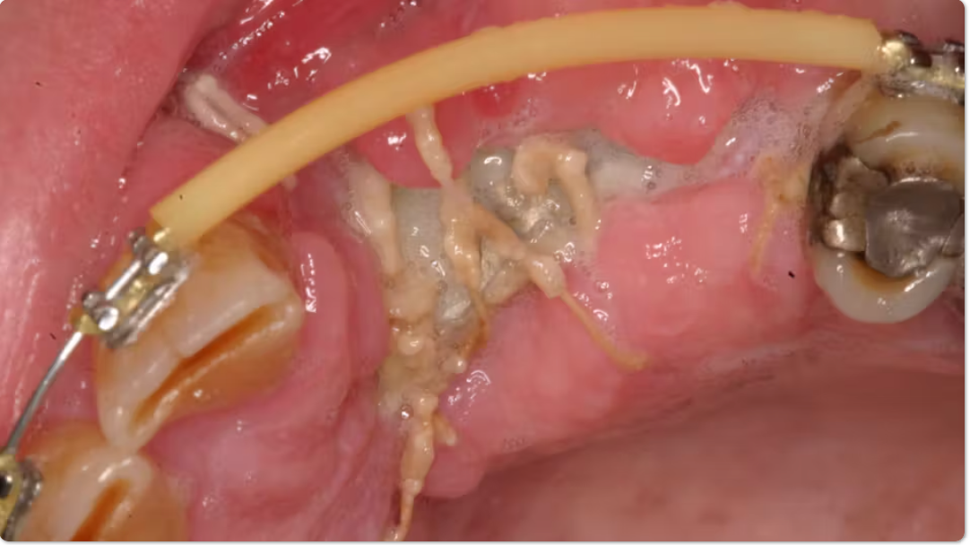 Why do incision lines open, and what can I do about it? by  Dr. Scott Froum Image