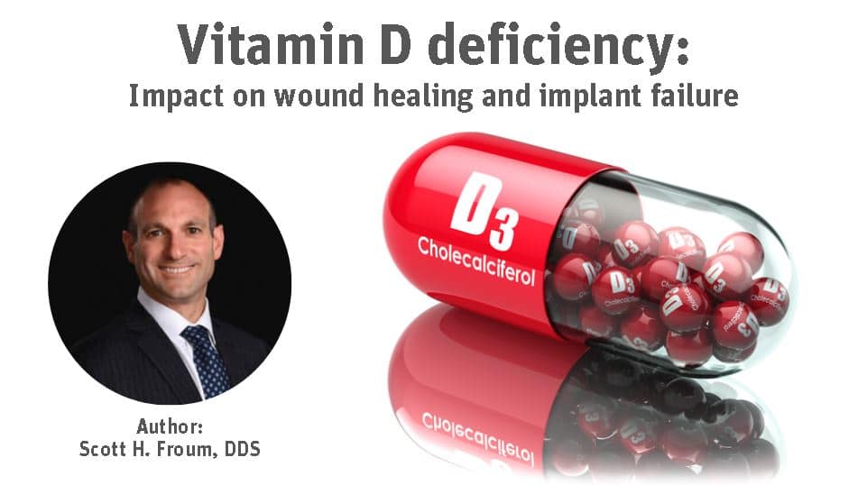 Vitamin D Deficiency: Impact on wound healing and implant failure Image