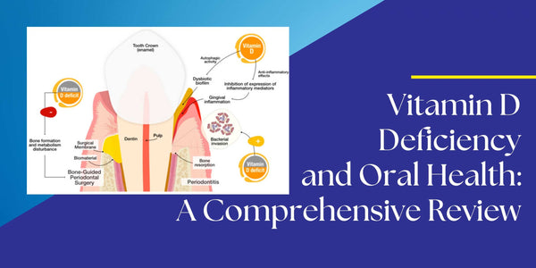 Vitamin D Deficiency and Oral Health: A Comprehensive Review