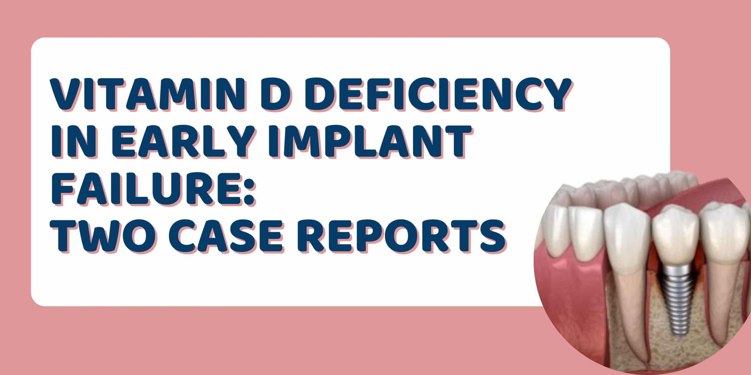 Vitamin D deficiency in Early Implant Failure: Two Case Reports Image
