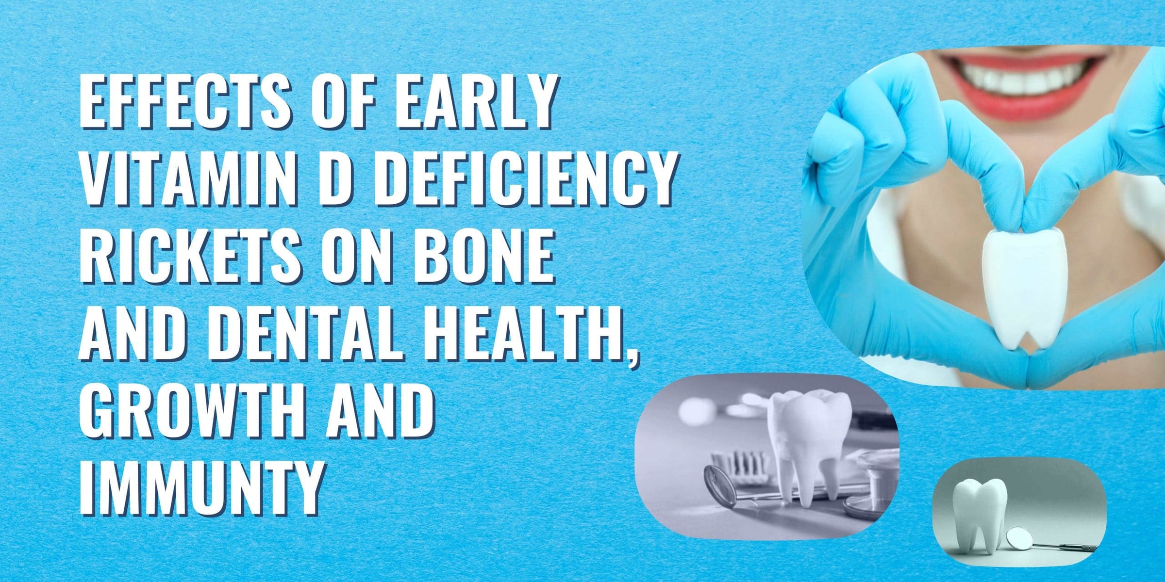 Effects of early vitamin D deficiency rickets on bone and dental health, growth and immunity Image